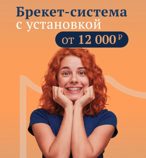 Брекеты с установкой от 10 000 Р